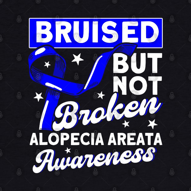 Survivor Blue Ribbon Alopecia gift by Toeffishirts